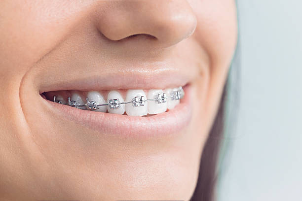 Best Invisalign and Clear Aligners  in Forsgate, NJ